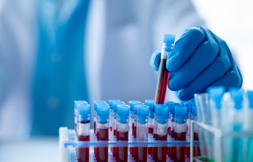 Adobestock 559095551