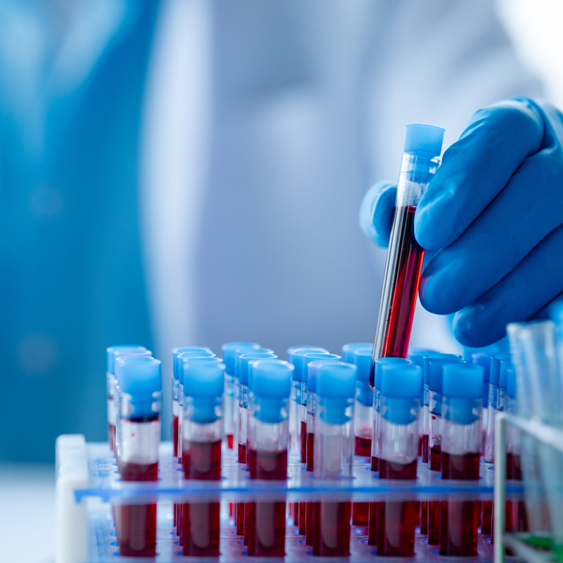 Adobestock 559095551